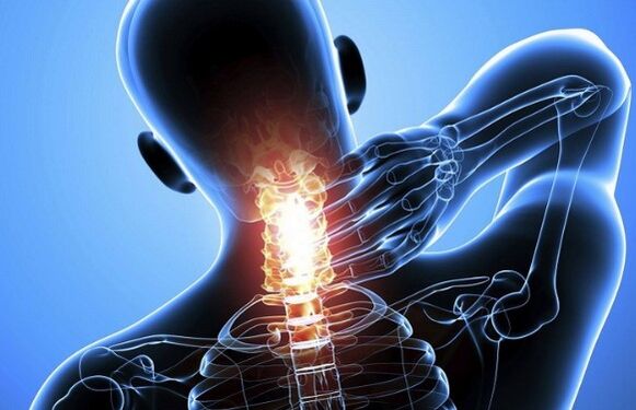 Neck pain