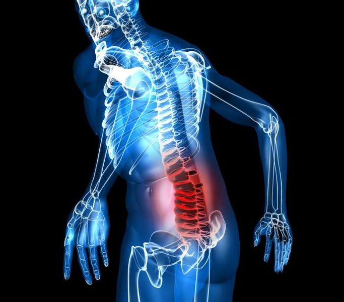 Degree and development stages of lumbar osteochondrosis