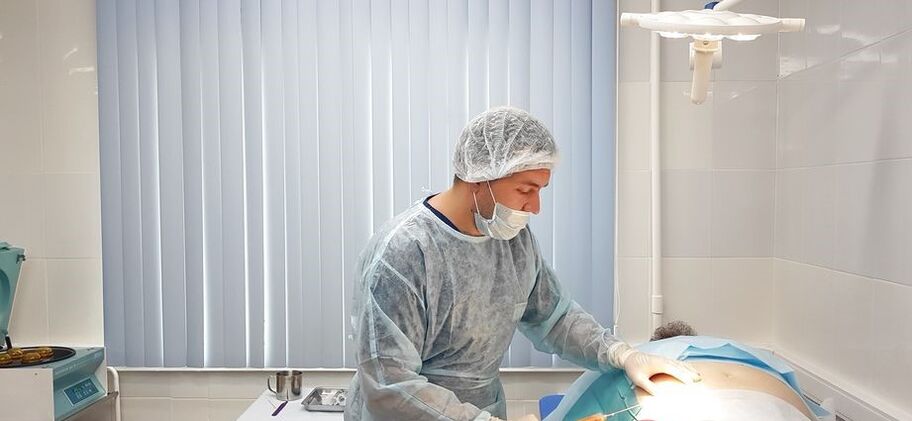 Adipose tissue sampling for SVF treatment of osteoarthritis of the knee joint