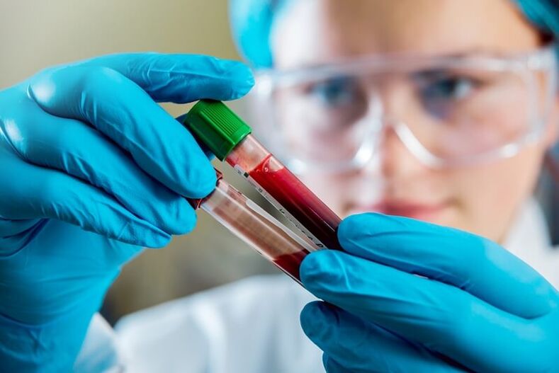 Complete blood test to diagnose low back pain.