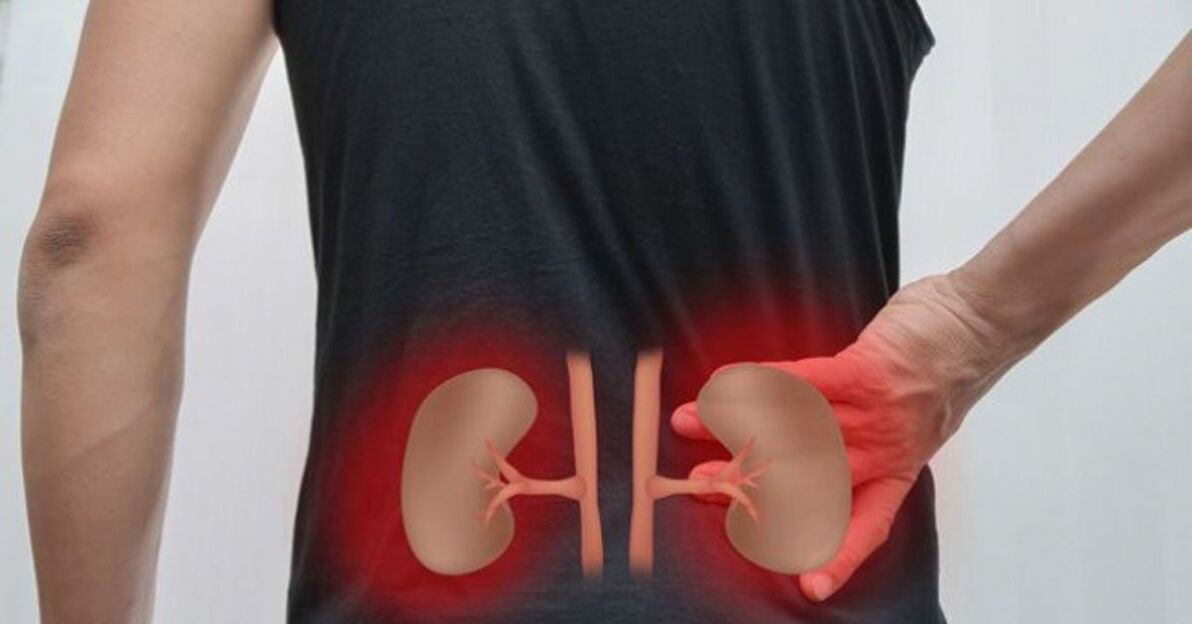 Inflammation of the kidneys can cause lower back pain.