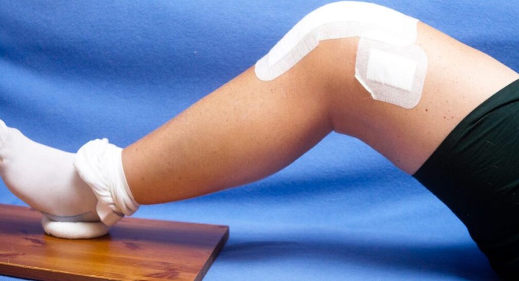 Injury to the knee joint is one of the causes of the development of osteoarthritis.